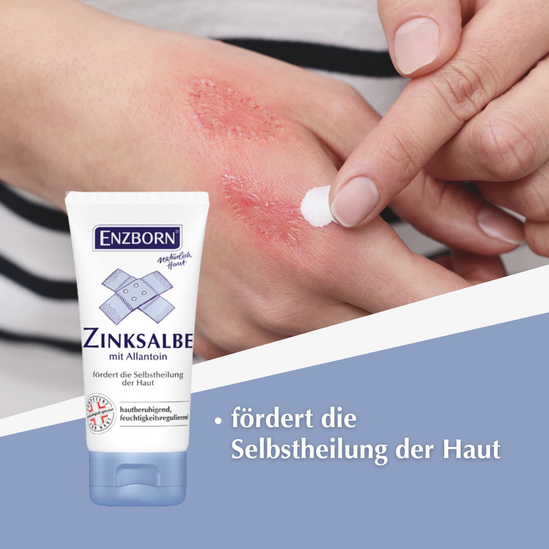 ENZBORN® Zinksalbe